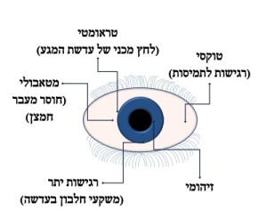 סיבוכי עדשות מגע ד"ר ניר ארדינסט